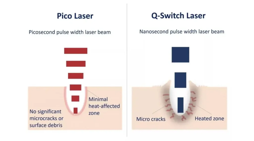 What Are The Differences between Pico and Q-Switched Laser?