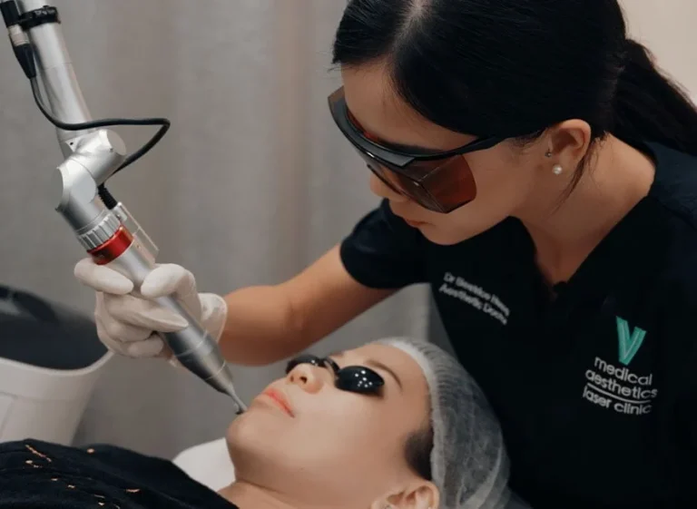 Pico Laser Treatment