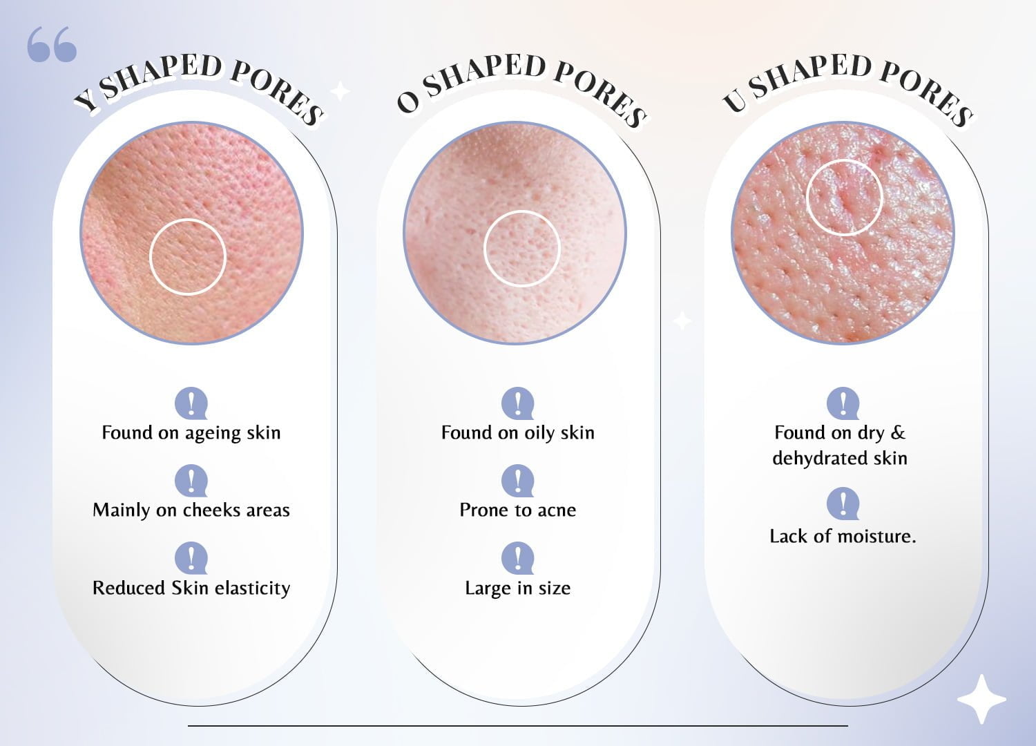 different shapes of pores