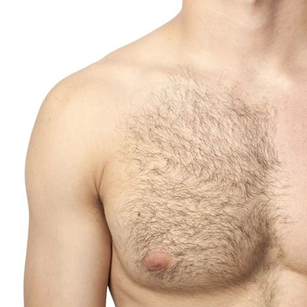 laser hair removal, chest hair