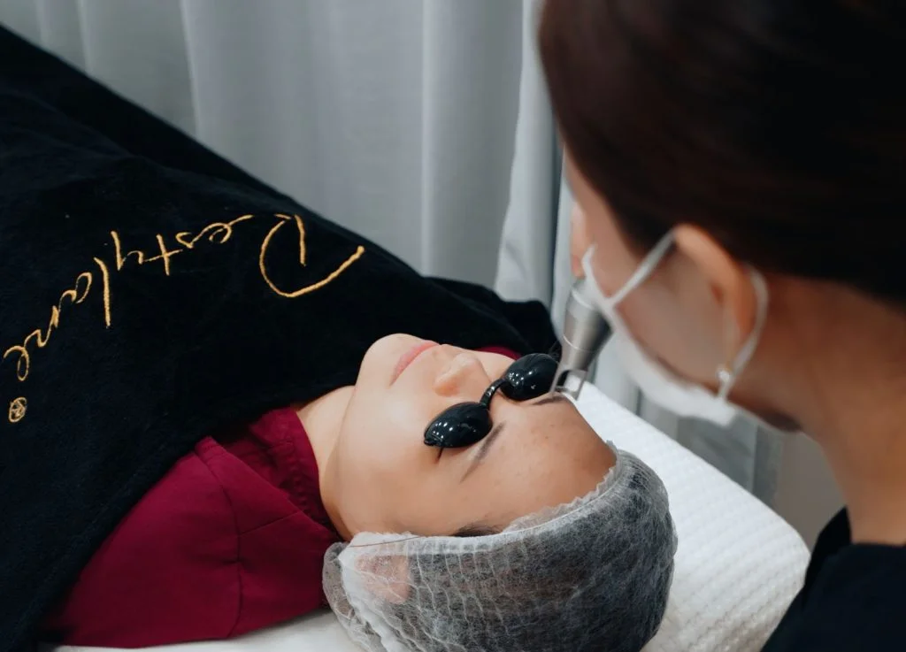girl treated with pico laser