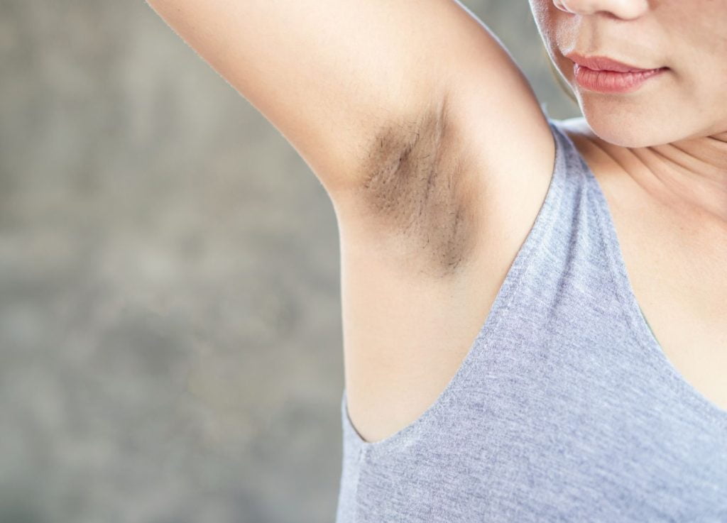 woman with dark armpits