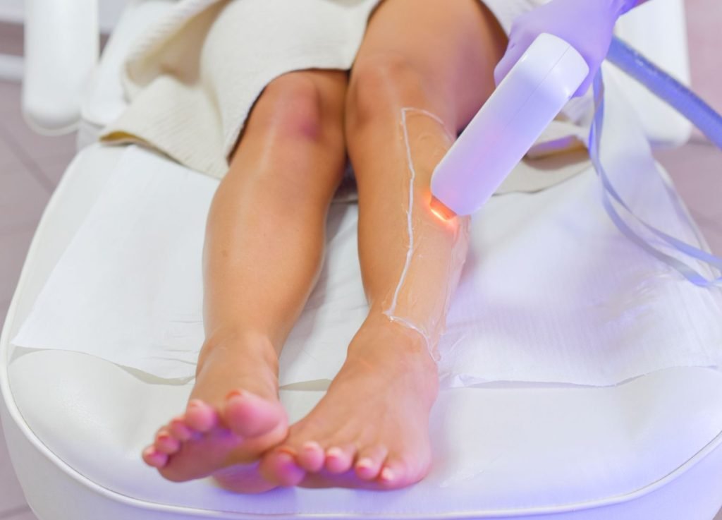 Is Laser Hair Removal permanent?