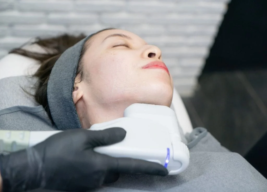 Can i do HIFU treatment every month?