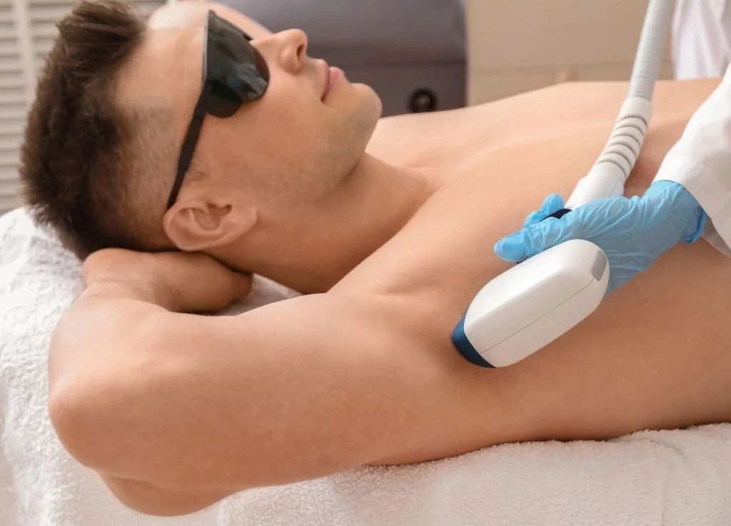 Ultimate Guide To Laser Hair Removal For Men