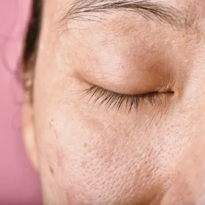 Signs of Aging