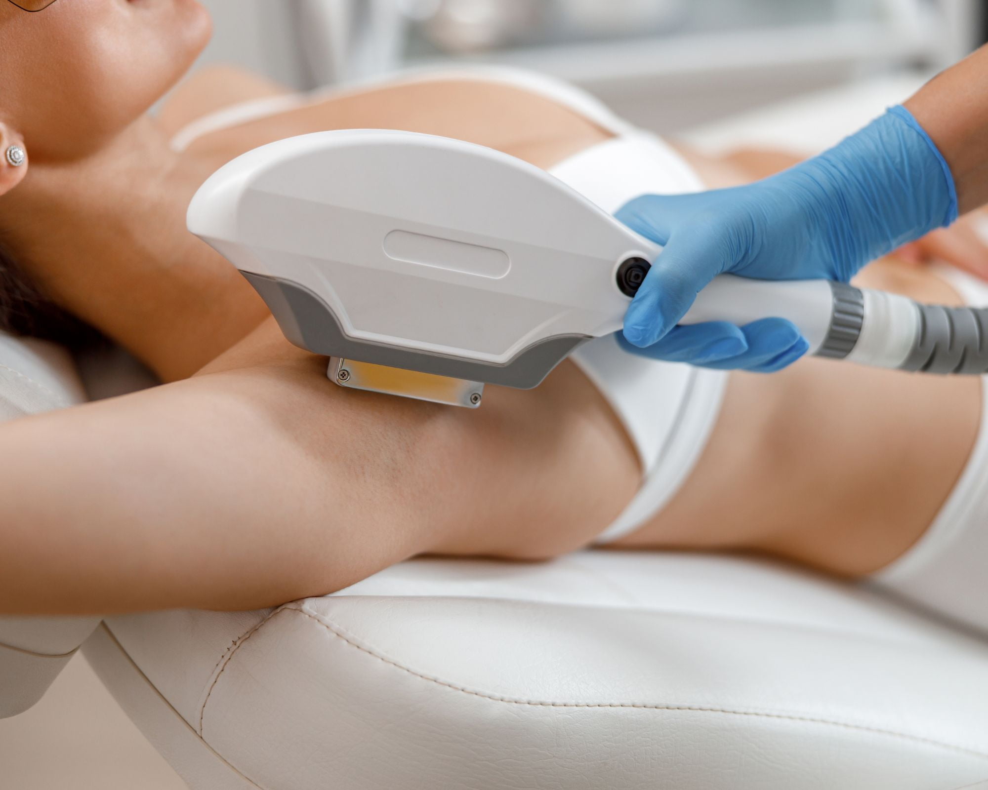 Laser Hair Removal 101