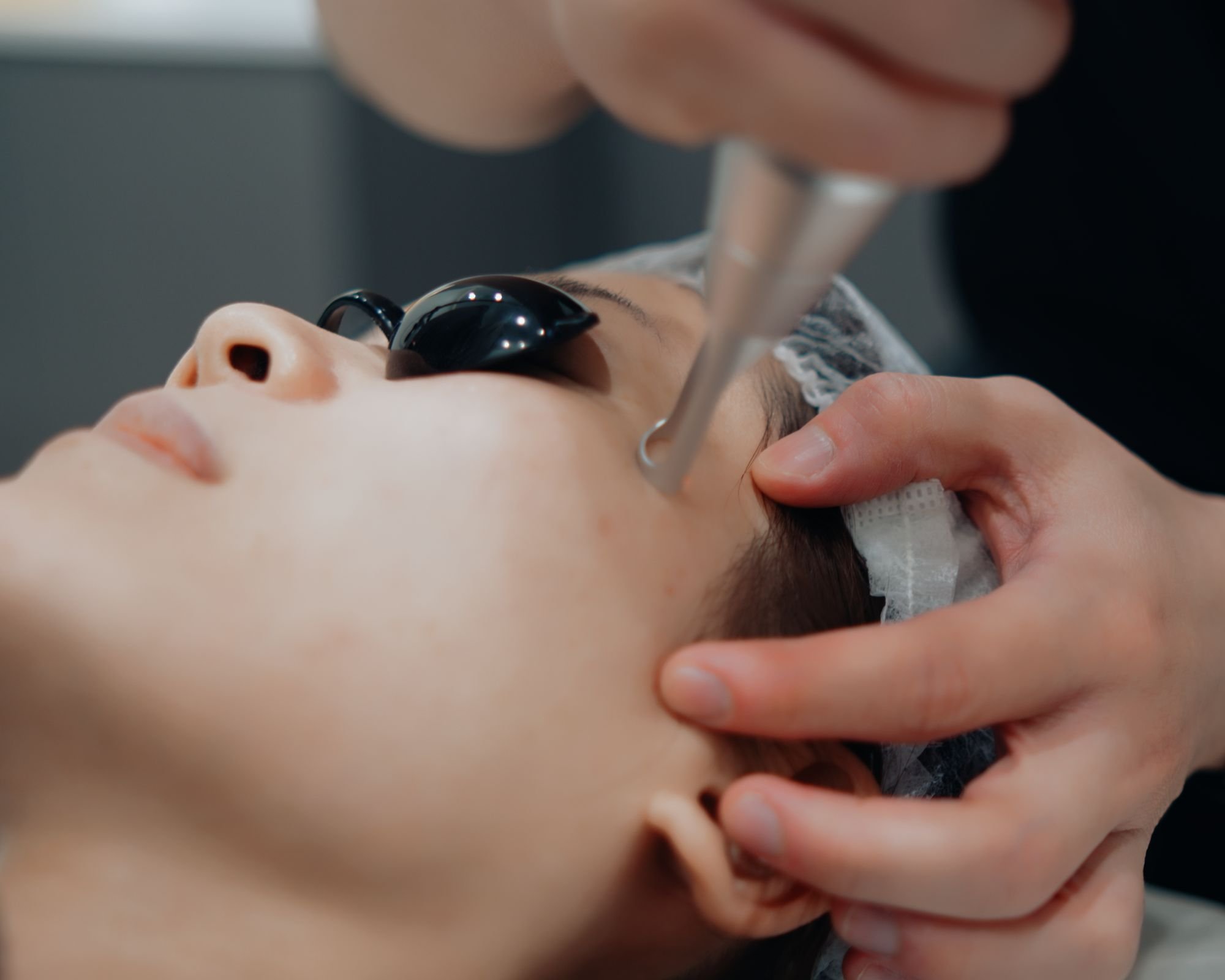 Best time to do Pico Laser