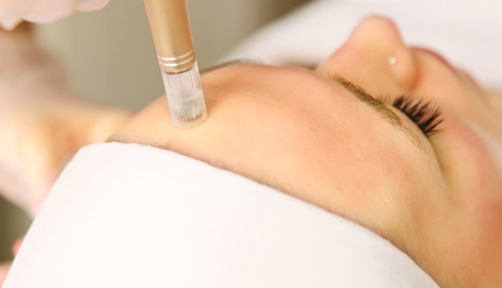 RF-Microneedling---A-Revolution-in-Skin-Rejuvenation---VMED