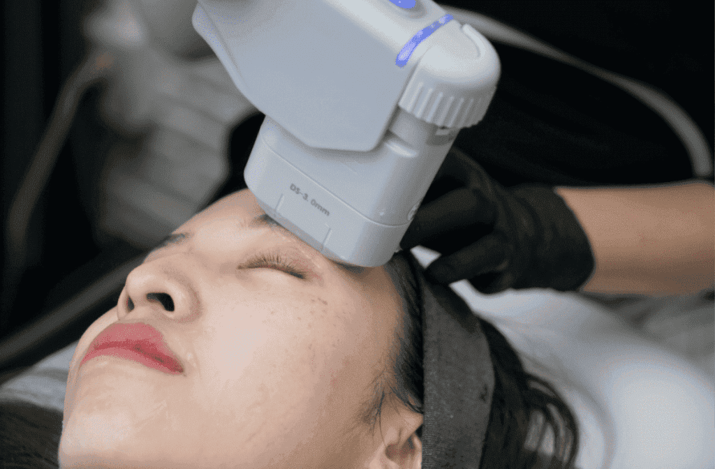HIFU Treatment In Singapore