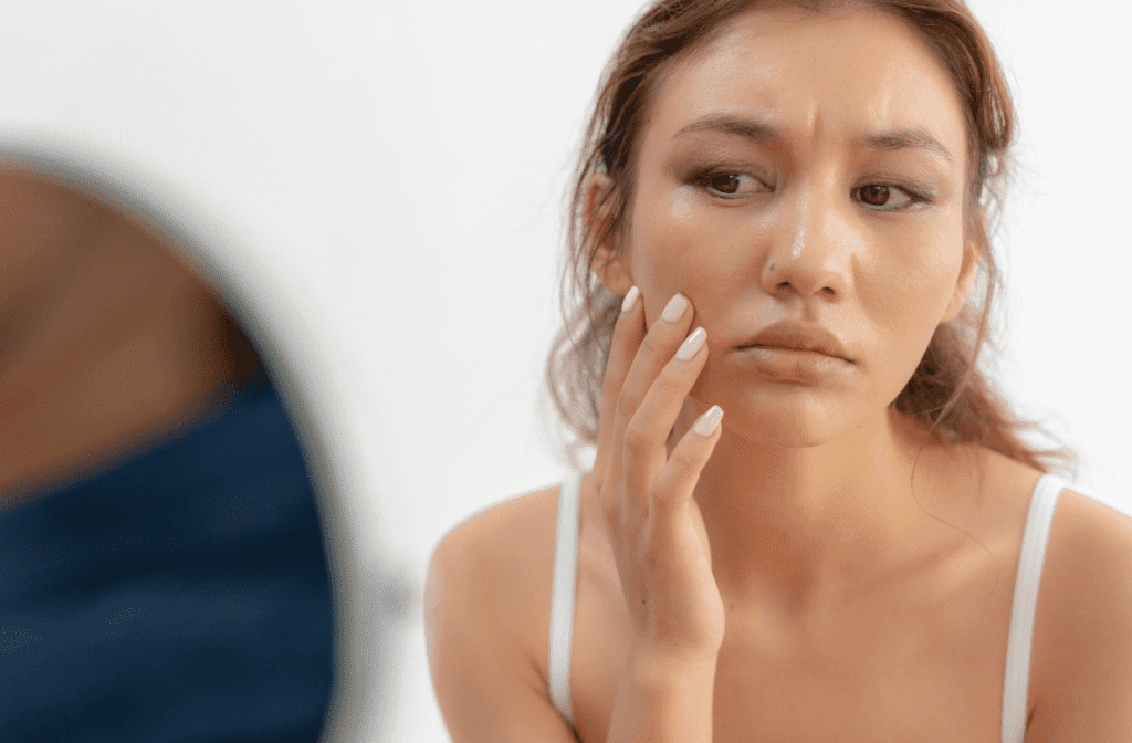 Soothe Your Skin with Non-Surgical Rosacea Treatment in SG