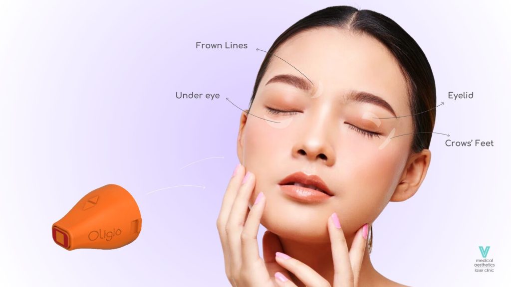 Oligio Eye Tip Treatment Area