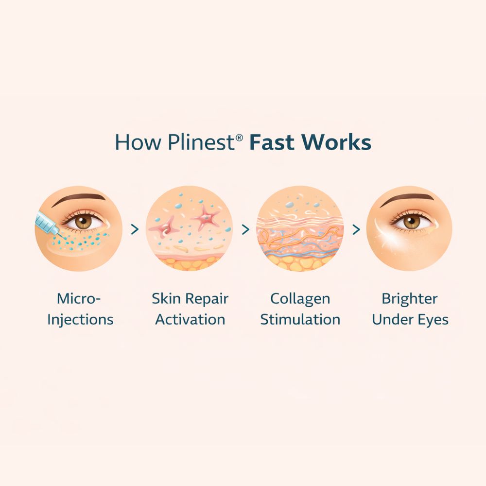 How Plinest Fast Work