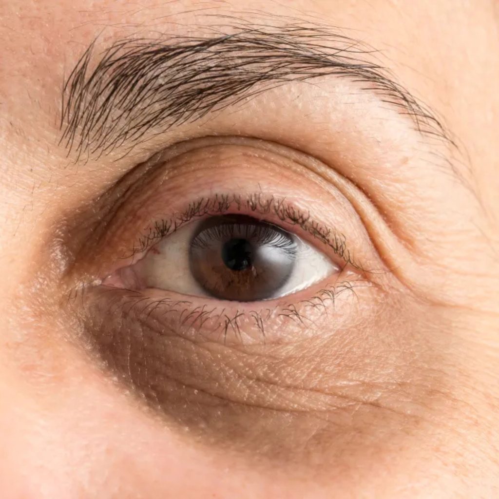 Mixed Type Dark Circles