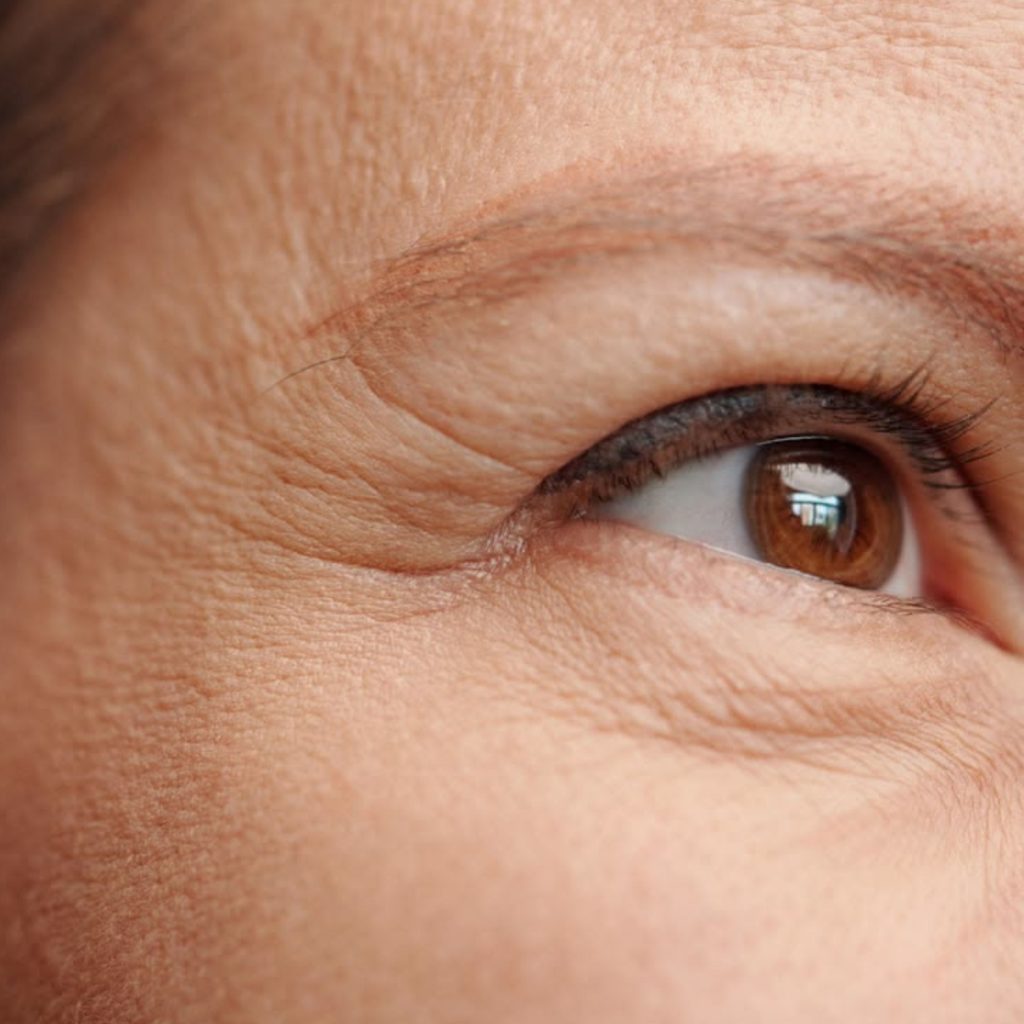 eye fine line and wrinkles
