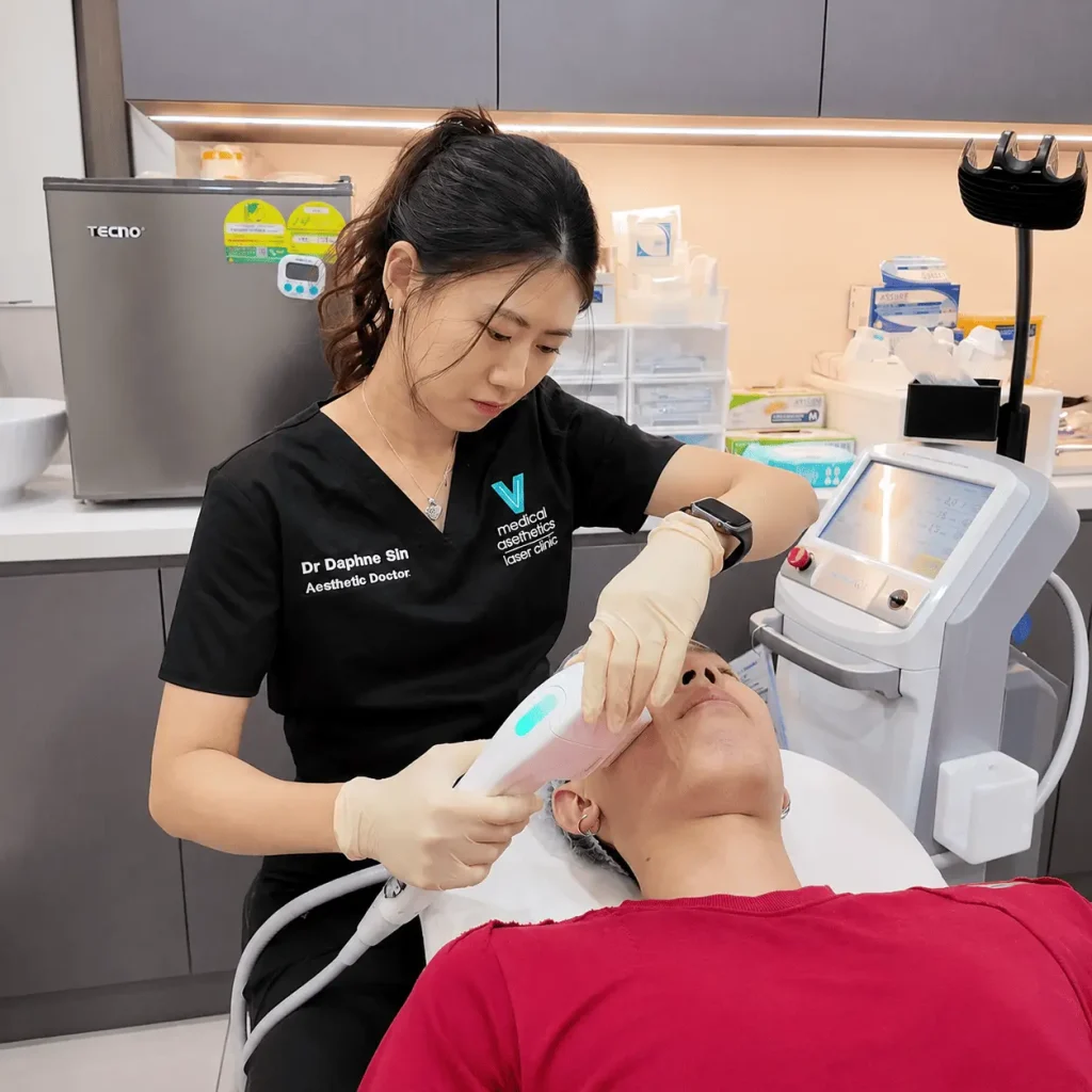 laser treatment