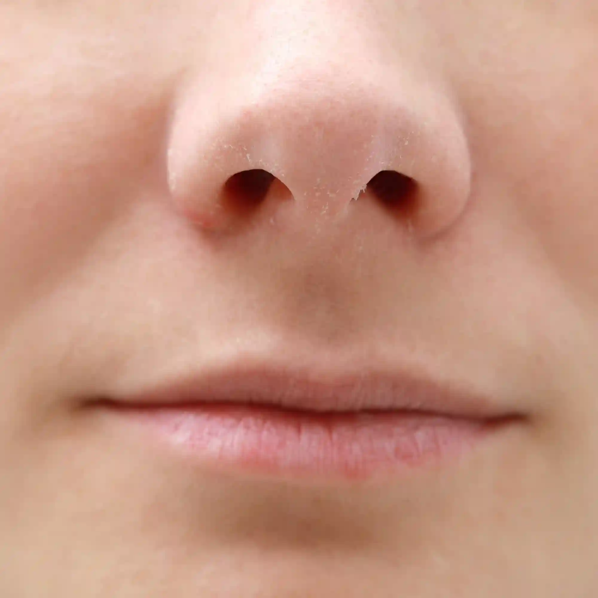 midface