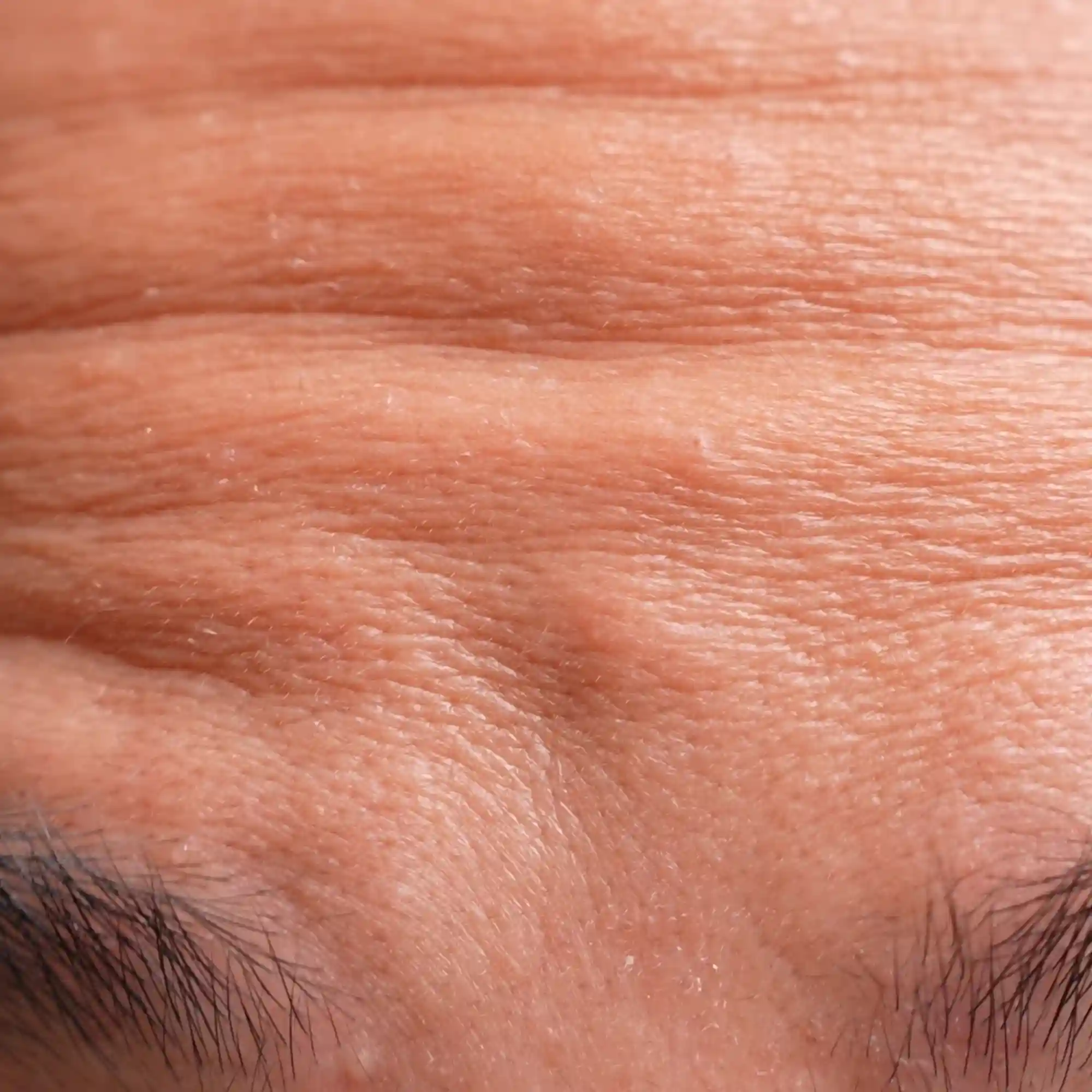 forehead